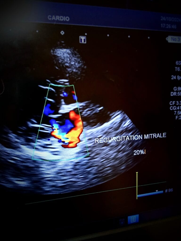 Echocardio